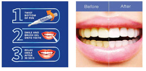Teeth Whitening Pen Trustify