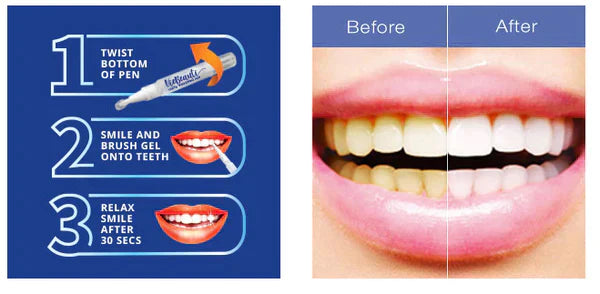 Teeth Whitening Pen Trustify