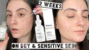 The Ordinary Hyaluronic Acid 2% + B5 30ml Serum For Face Trustify